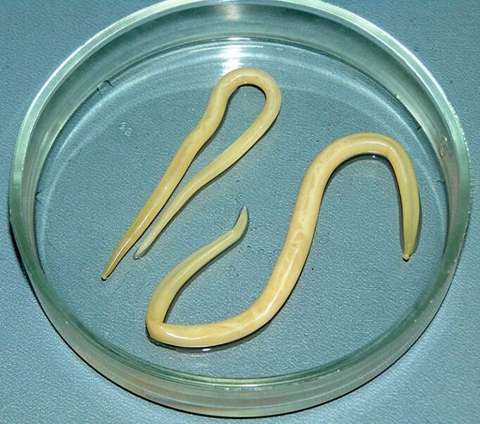 parasite worm from the human body