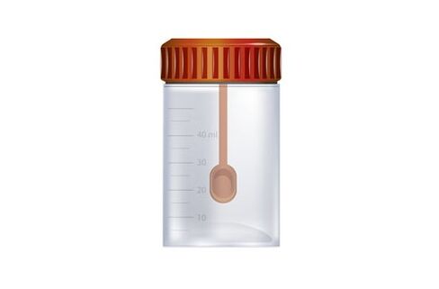 stool collection container for parasite analysis