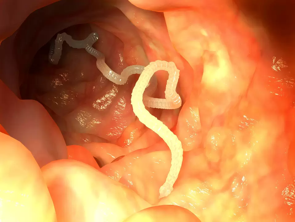 human esophagus parasitic worm