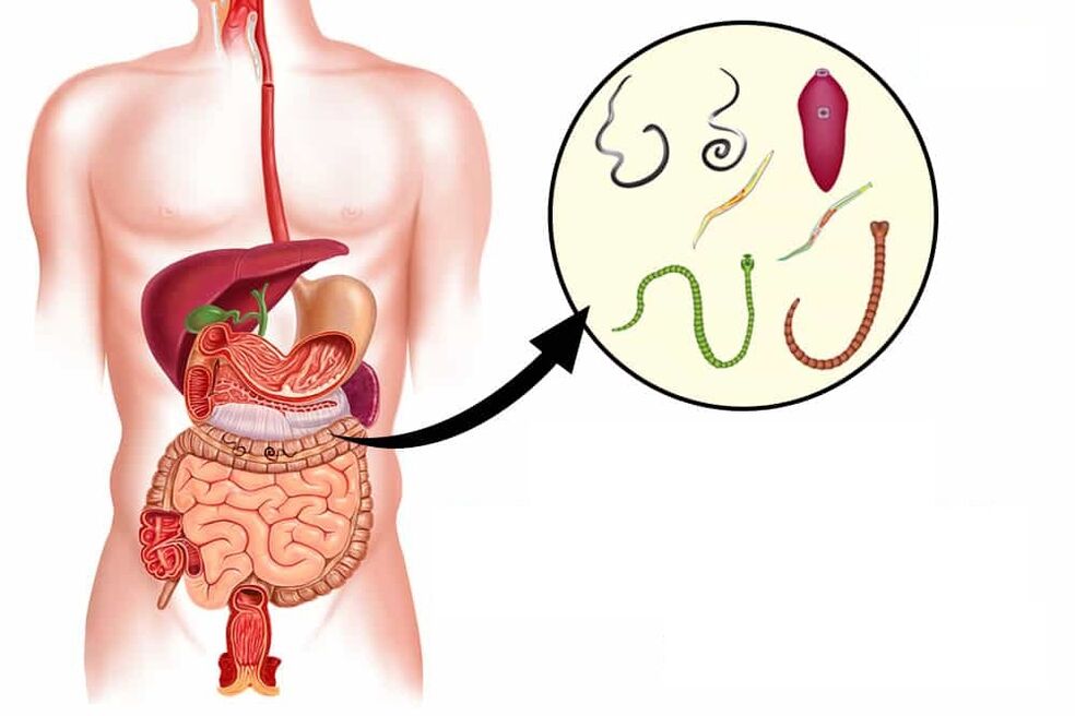 worms in the human intestine