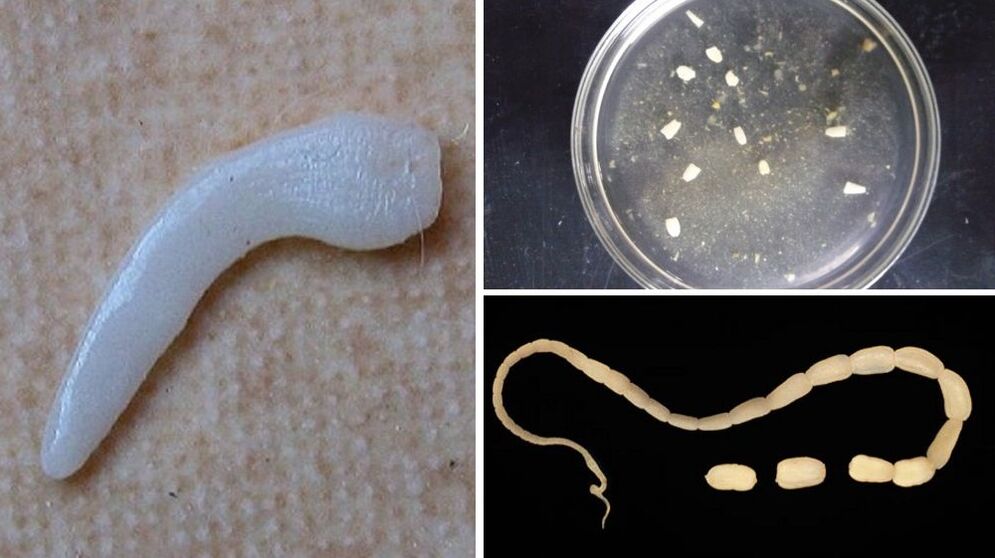 parasites from the human body