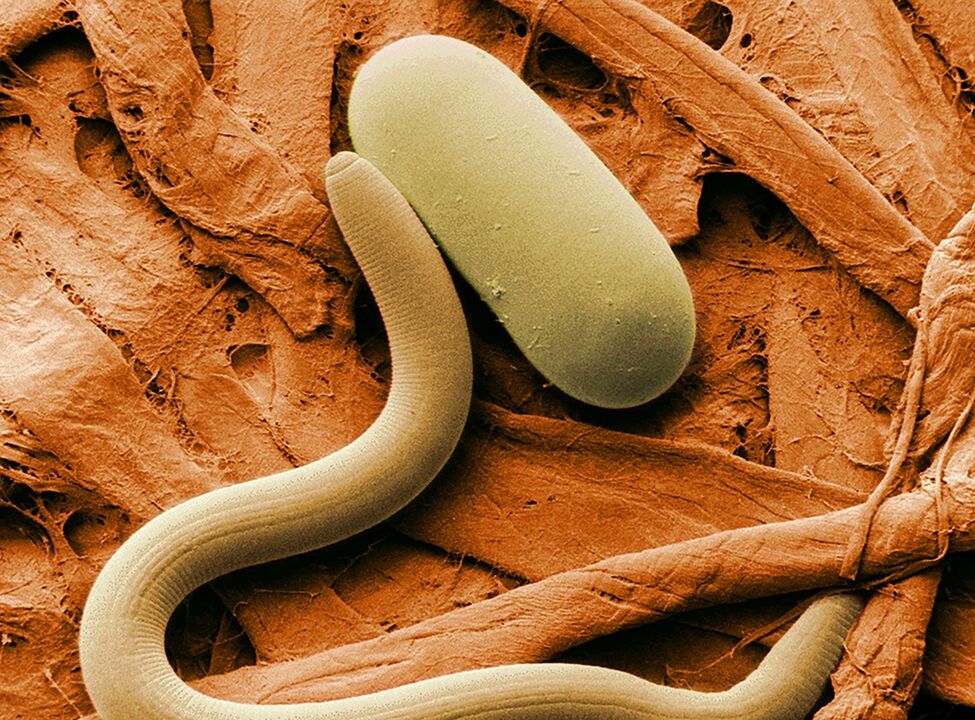 how worm infection occurs