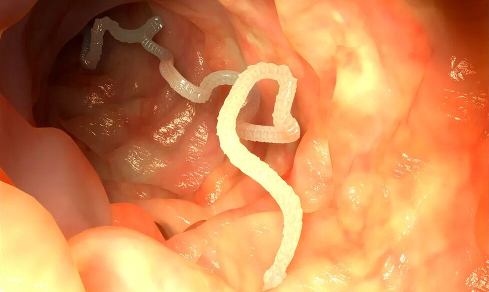 Luminal worms infect the intestine