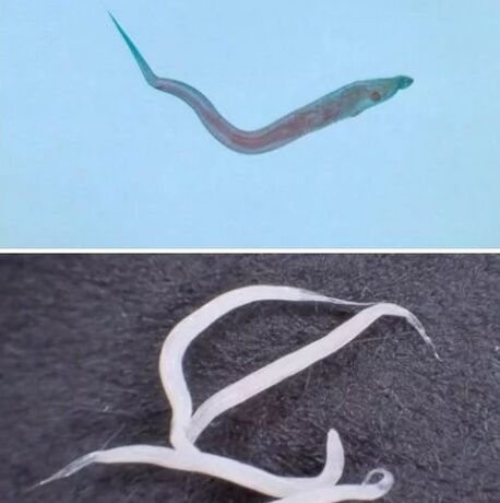 Types of parasites in the human body
