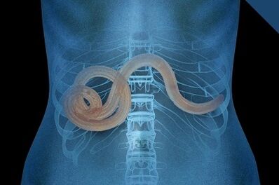 Parasites in the human body