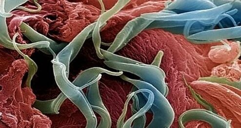 picture of parasites in the human body