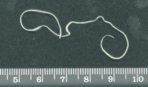 Female heartworm extracted from under the skin